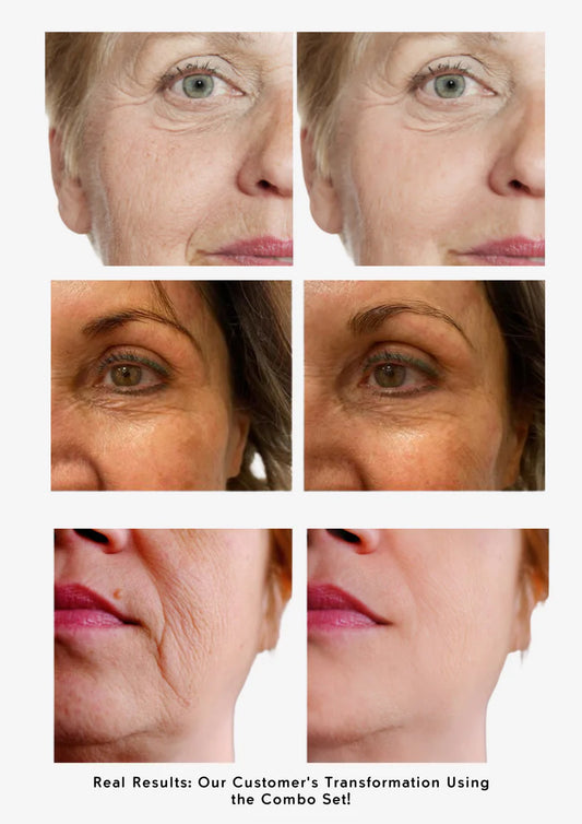 Youthful Skin Combo Set – Smooth Fine Lines & Restore Radiance